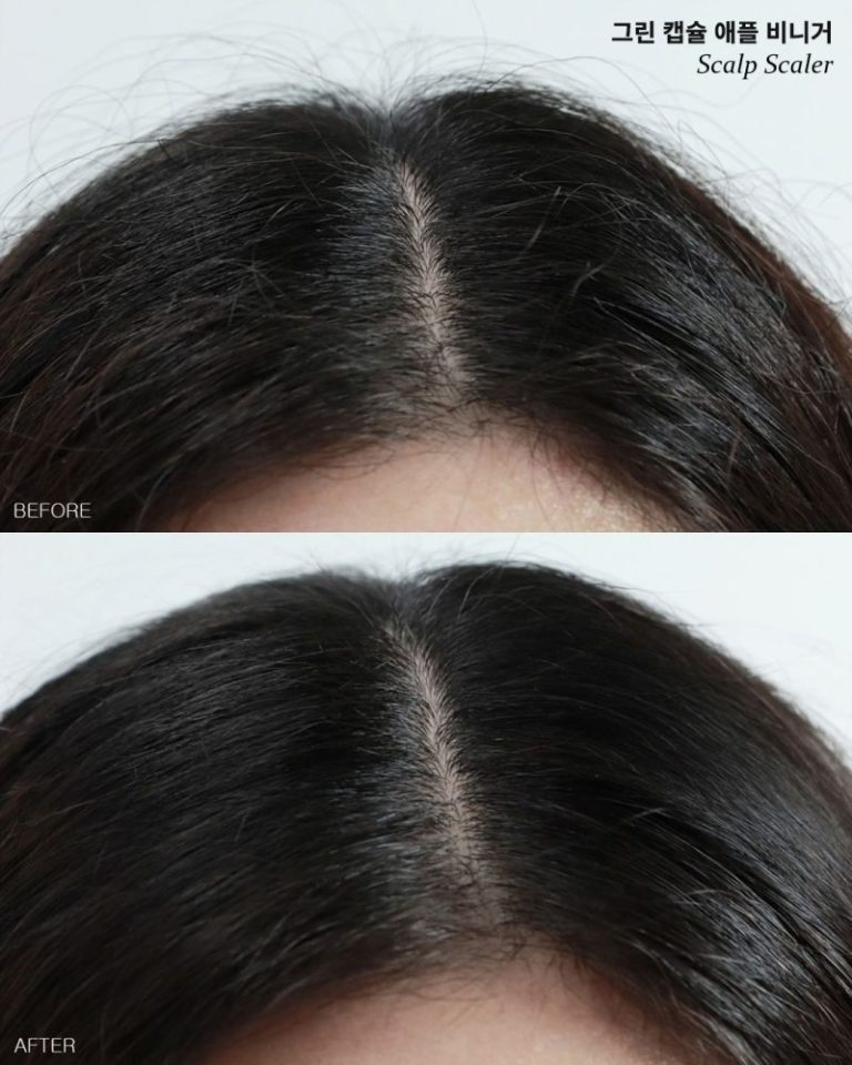 Ексфолиант за скалп с чаено дърво и ябълков оцет Trimay Green Capsule Apple Vinegar Scalp Scaler
