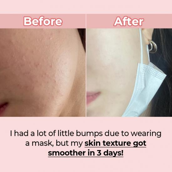 Numbuzin No,3 Skin Softening Serum - Koreancare