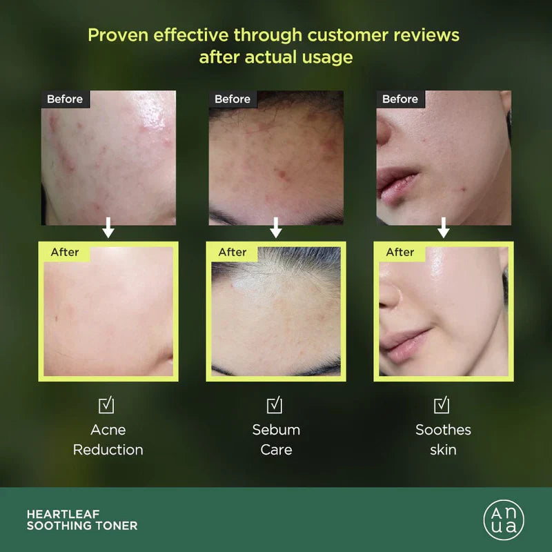 Anua Heartleaf 77% Soothing Toner 500ml - Koreancare