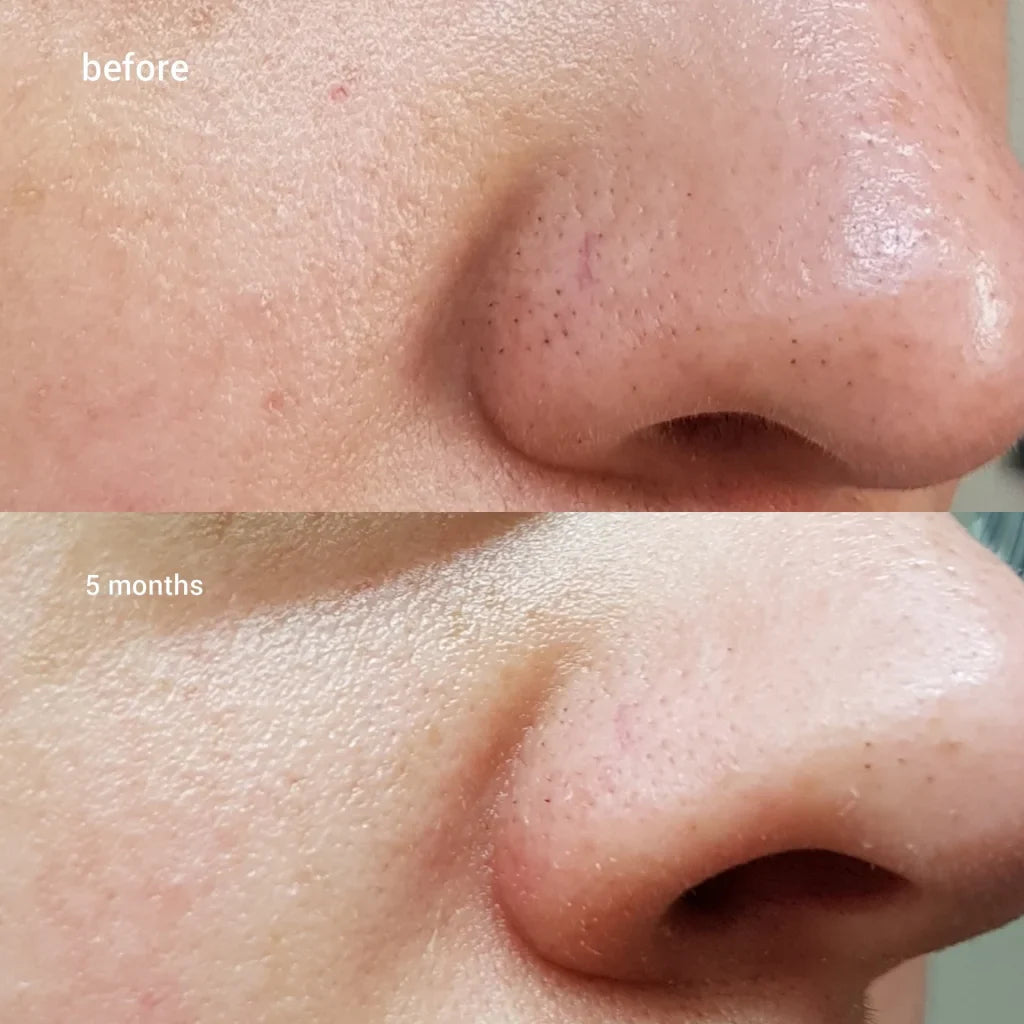 Ексфолираща есенция COSRX BHA Blackhead Power Liquid