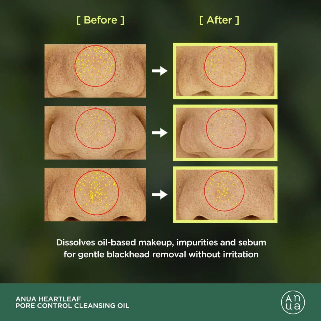 Почистващо олио ANUA Heartleaf Pore Control Cleansing Oil