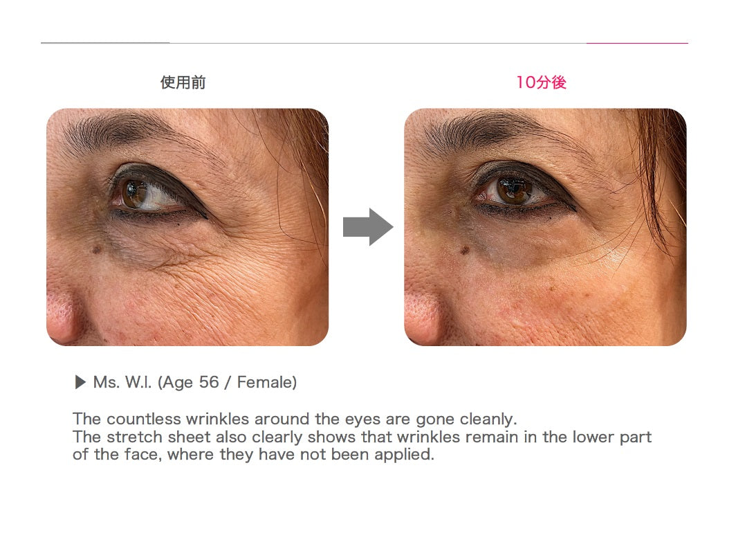 Пачове за очи с роза Rosy drop Stretch Sheets eye patches- единична опаковка 2бр