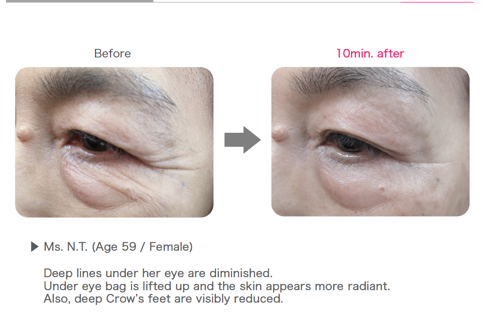 Пачове за очи с роза Rosy drop Stretch Sheets eye patches- единична опаковка 2бр